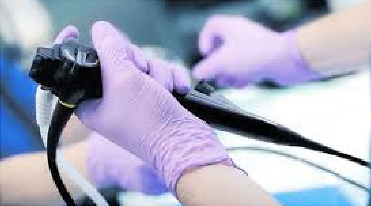 Endoscopía digestiva